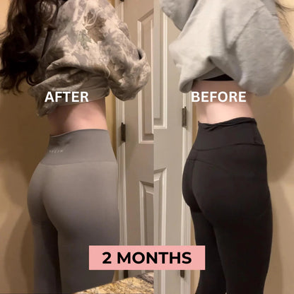 Curvessa™ Booty Workout Bands-Set